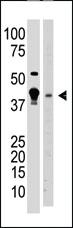 Anti-MBD2 Rabbit Polyclonal Antibody