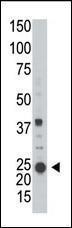 Anti-ARL3 Rabbit Polyclonal Antibody (HRP (Horseradish Peroxidase))