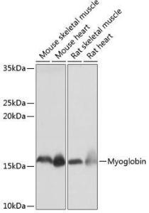 Western blot analysis of extracts of various cell lines, using Anti-Myoglobin Antibody [ARC0582] (A80498) at 1:1,000 dilution. The secondary antibody was Goat Anti-Rabbit IgG H&L Antibody (HRP) at 1:10,000 dilution.