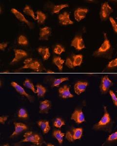 Anti-OBSCN antibody