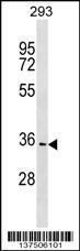 Anti-PBLD Rabbit Polyclonal Antibody (Biotin)