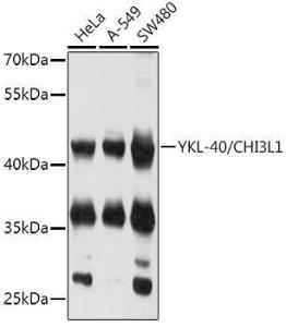 Anti-YKL-40/CHI3L1 antibody