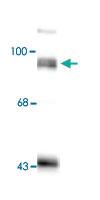 Anti-DLG4 Rabbit Polyclonal Antibody