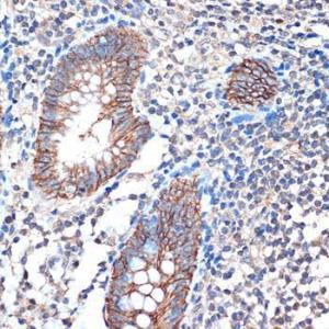 Immunohistochemistry analysis of paraffin-embedded human appendix tissue using Anti-LI Cadherin Antibody [ARC1989] (A307438) at a dilution of 1:100 (40X lens). Perform microwave antigen retrieval with 10 mM Tris/EDTA buffer pH 9.0 before commencing with IHC staining protocol