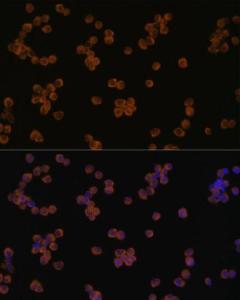 Anti-YKL-40/CHI3L1 antibody