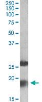 Anti-MPV17 Goat Polyclonal Antibody