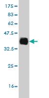 Anti-ELAC1 Mouse Monoclonal Antibody [clone: 1G2]