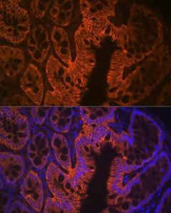 Immunofluorescence analysis of rat rectum using Anti-LI Cadherin Antibody [ARC1989] (A307438) at a dilution of 1:100 (40X lens). DAPI was used to stain the cell nuclei (blue)