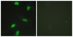 Immunofluorescence analysis of HeLa cells using Anti-Retinoblastoma (phospho Thr821) Antibody. The right hand panel represents a negative control, where the antibody was pre-incubated with the immunising peptide