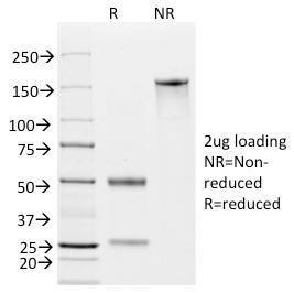 SDS-PAGE analysis of Anti-EpCAM Antibody [EGP40/837] under non-reduced and reduced conditions; showing intact IgG and intact heavy and light chains, respectively. SDS-PAGE analysis confirms the integrity and purity of the antibody