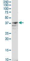 Anti-B4GALT4 Rabbit Polyclonal Antibody