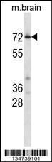 Anti-CDK17 Rabbit Polyclonal Antibody (APC (Allophycocyanin))