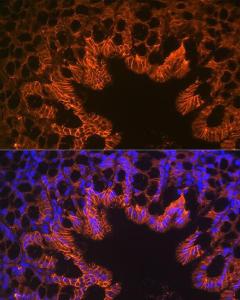 Immunofluorescence analysis of mouse large intestine using Anti-LI Cadherin Antibody [ARC1989] (A307438) at a dilution of 1:100 (40X lens). DAPI was used to stain the cell nuclei (blue)