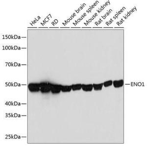 Western blot analysis of extracts of various cell lines, using Anti-ENO1 Antibody [ARC0599] (A80514) at 1:1000 dilution. The secondary Antibody was Goat Anti-Rabbit IgG H&L Antibody (HRP) at 1:10000 dilution. Lysates/proteins were present at 25 µg per lane