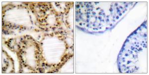 Immunohistochemical analysis of paraffin-embedded human testis using Anti-Retinoblastoma (phospho Thr821) Antibody. The right hand panel represents a negative control, where the antibody was pre-incubated with the immunising peptide