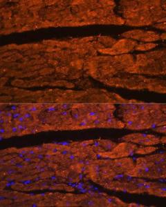 Anti-OBSCN antibody