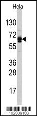 Anti-USP21 Rabbit Polyclonal Antibody