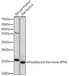 Western blot analysis of extracts of various cell lines, using Anti-Parathyroid Hormone Antibody [ARC1709] (A307439) at 1:1,000 dilution. The secondary antibody was Goat Anti-Rabbit IgG H&L Antibody (HRP) at 1:10,000 dilution.