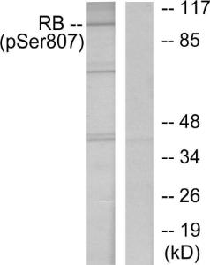 Western blot analysis of lysates from K562 cells treated with serum 10% using Anti-Retinoblastoma (phospho Ser807) Antibody. The right hand lane represents a negative control, where the antibody is blocked by the immunising peptide.