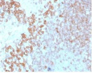 Immunohistochemical analysis of formalin-fixed, paraffin-embedded human tonsil tissue using Anti-CD27 Antibody [LPFS2/4178]