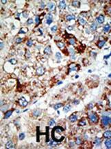 Anti-USP21 Rabbit Polyclonal Antibody