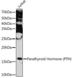 Western blot analysis of extracts of Jurkat cells, using Anti-Parathyroid Hormone Antibody [ARC1709] (A307439) at 1:1,000 dilution. The secondary antibody was Goat Anti-Rabbit IgG H&L Antibody (HRP) at 1:10,000 dilution.