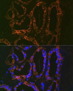 Immunofluorescence analysis of human thyroid using Anti-Parathyroid Hormone Antibody [ARC1709] (A307439) at a dilution of 1:100 (40x lens). DAPI was used to stain the cell nuclei (blue).