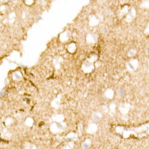 Immunohistochemistry analysis of paraffin-embedded human brain tissue using Anti-Aquaporin 4 Antibody [ARC54345] (A80530) at a dilution of 1:200 (40x lens). Perform high pressure antigen retrieval with 10 mM citrate buffer pH 6.0 before commencing with IHC staining protocol.