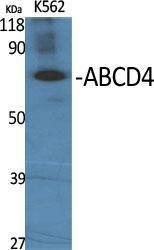 Western blot analysis of various cells using Anti-ABCD4 Antibody