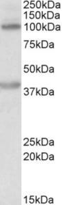 EB10813 (0.2 µg/ml) staining of Human Liver lysate (35 µg protein in RIPA buffer). Primary incubation was 1 hour. Detected by chemiluminescence.