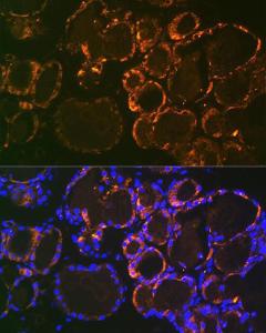 Immunofluorescence analysis of mouse thyroid using Anti-Parathyroid Hormone Antibody [ARC1709] (A307439) at a dilution of 1:100 (40x lens). DAPI was used to stain the cell nuclei (blue).