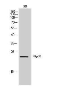 Western blot analysis of KB cells using Anti-NCR3 Antibody