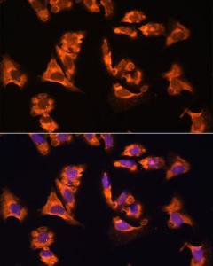 Anti-OBSCN antibody