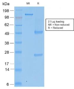 SDS-PAGE analysis of Anti-TIMP2 Antibody [rTIMP2/2335] under non-reduced and reduced conditions; showing intact IgG and intact heavy and light chains, respectively. SDS-PAGE analysis confirms the integrity and purity of the antibody