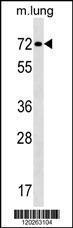 Anti-TFE3 Rabbit Polyclonal Antibody (FITC (Fluorescein Isothiocyanate))