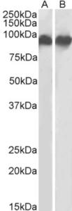 EB12559 (0.3 µg/ml) staining of K562 (A) and U937 (B) lysates (35 µg protein in RIPA buffer). Primary incubation was 1 hour. Detected by chemiluminescence.