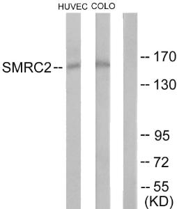 Anti-SMRC2 Rabbit Polyclonal Antibody