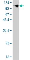 Anti-STAT3 Mouse Monoclonal Antibody [clone: 1D11-2A11]