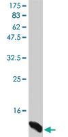 Anti-CSF2 Mouse Monoclonal Antibody [clone: 3B4]