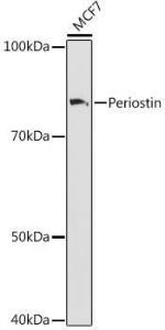 Western blot analysis of extracts of MCF7 cells, using Anti-Periostin Antibody [ARC1380] (A307441) at 1:1000 dilution