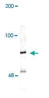 Anti-RPH3A Rabbit Polyclonal Antibody