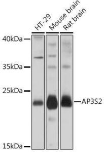 Anti-AP3S2 Rabbit Polyclonal Antibody