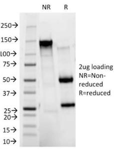 Anti-HER2 antibody