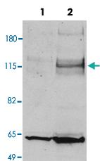 Anti-PML Rabbit Polyclonal Antibody