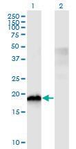 Anti-CIRBP Mouse Monoclonal Antibody [clone: 1C9]