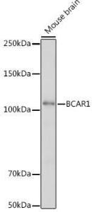 Anti-BCAR1 antibody