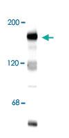 Anti-GRIN2B Rabbit Polyclonal Antibody