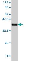 Anti-SEMA7A Mouse Monoclonal Antibody [clone: 3D3]