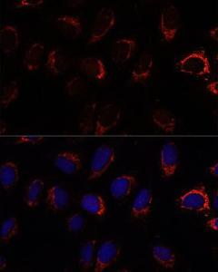 Anti-AP3S2 Rabbit Polyclonal Antibody