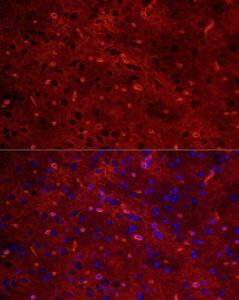 Immunofluorescence analysis of mouse brain using Anti-Aquaporin 4 Antibody [ARC54345] (A80530) at a dilution of 1:100 (40x lens). DAPI was used to stain the cell nuclei (blue).